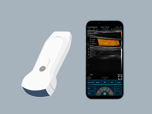 Cardiac preset mode on Dolphin C10RL dual-probe multipurpose ultrasound